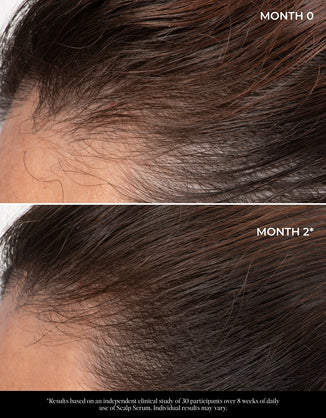 Let There Be Hair Scalp Serum