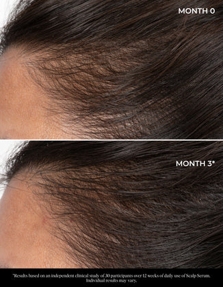 Let There Be Hair Scalp Serum