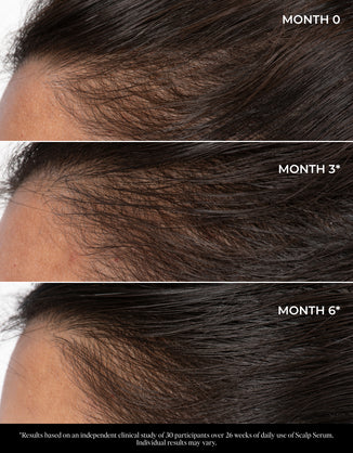 Let There Be Hair Scalp Serum