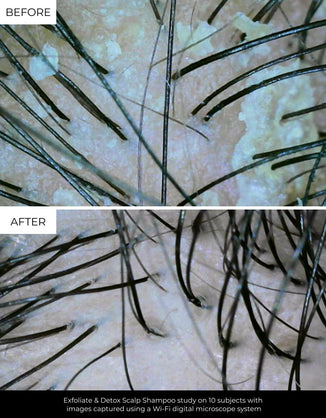 Jen's Scalp Transformation Essentials