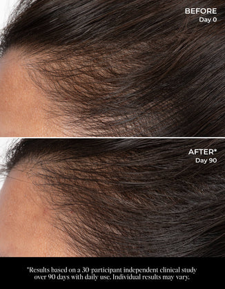 Jen's Scalp Transformation Essentials