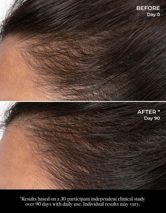 Let There Be Hair Scalp Serum