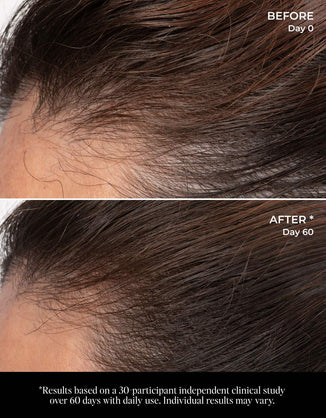 Let There Be Hair Scalp Serum